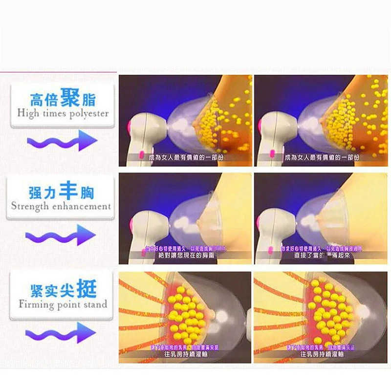 Dụng cụ mát xa nâng ngực hút chân không Shuteng-MTN407 | máy tập săn chắc ngực dành cho nữ